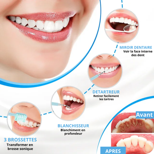 KIT DE BLANCHIMENT DENTAIRE A DOMICILE